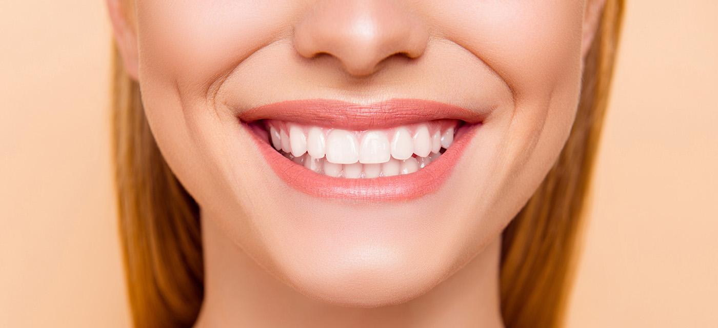 Mujer enseñando su sonrisa dental