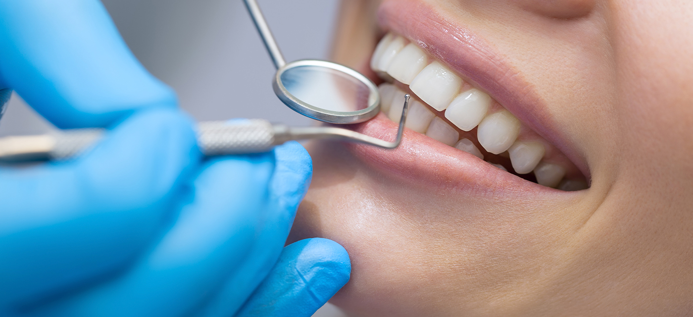 Mujer realizándose blanqueamiento dental