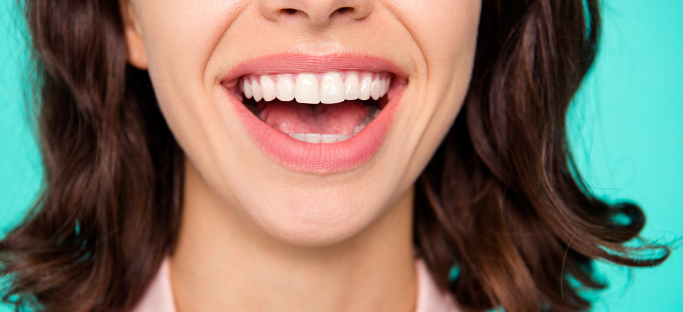 mujer tratada por periodontitis